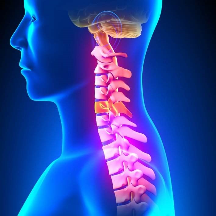 Boyun Fıtığı Boyun Fıtığı